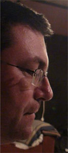 tal-babitzky